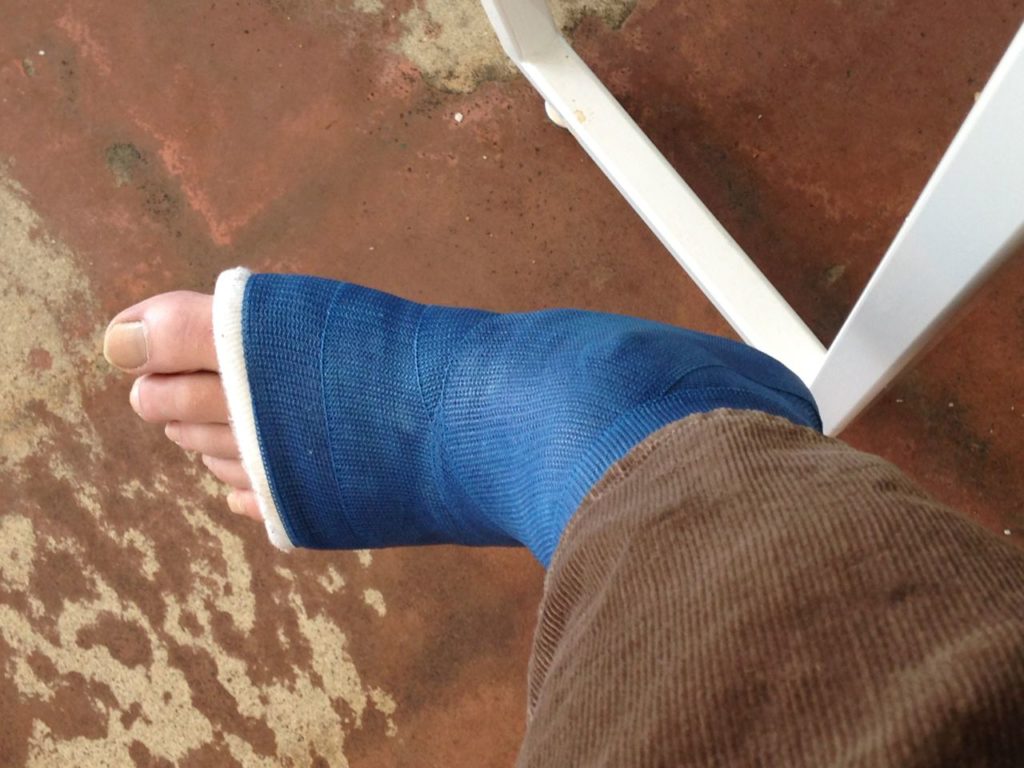 Blue cast